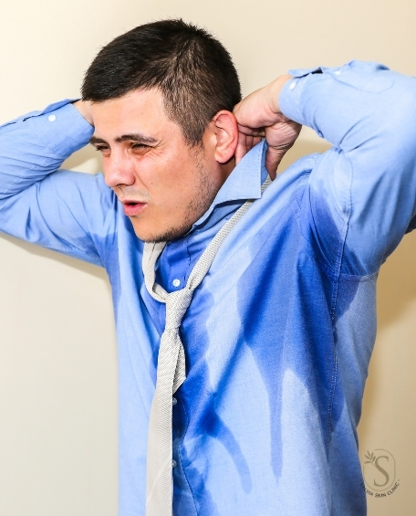 Excessive Sweating Treatment in Islamabad